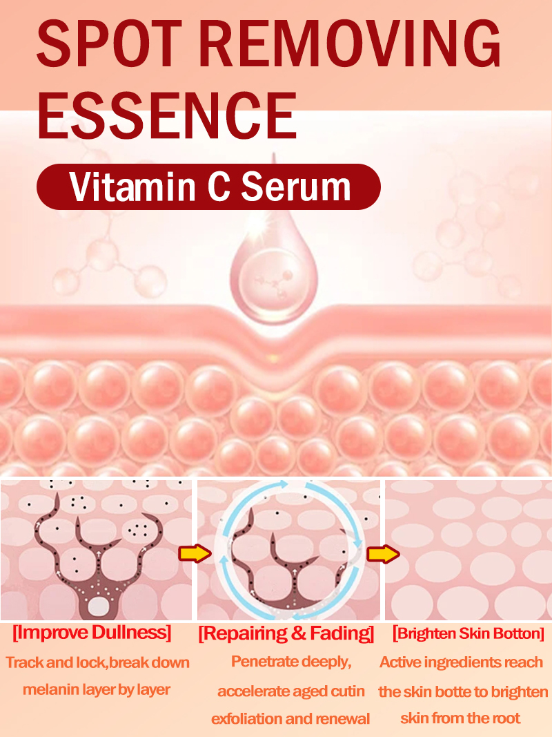 Verlicht sproeten Melasma, don - Luxury Skincare Essence recensie en prijs