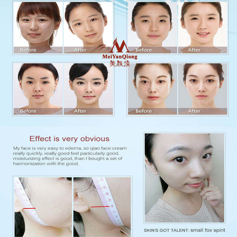 Gezicht Lifting Shaping Huidve - Luxury Skincare Anti Aging recensie en prijs